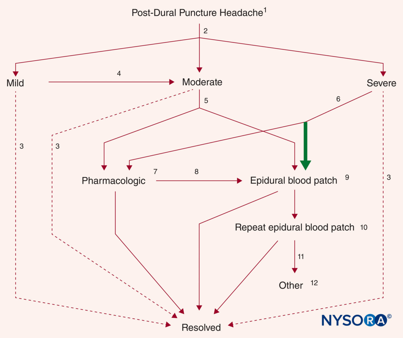 Dehydration Headache Location Chart