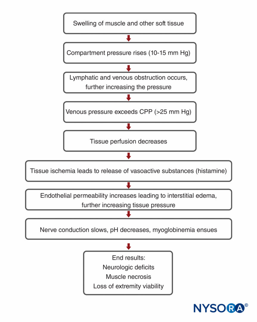 Sciatic Nerve Flow Chart