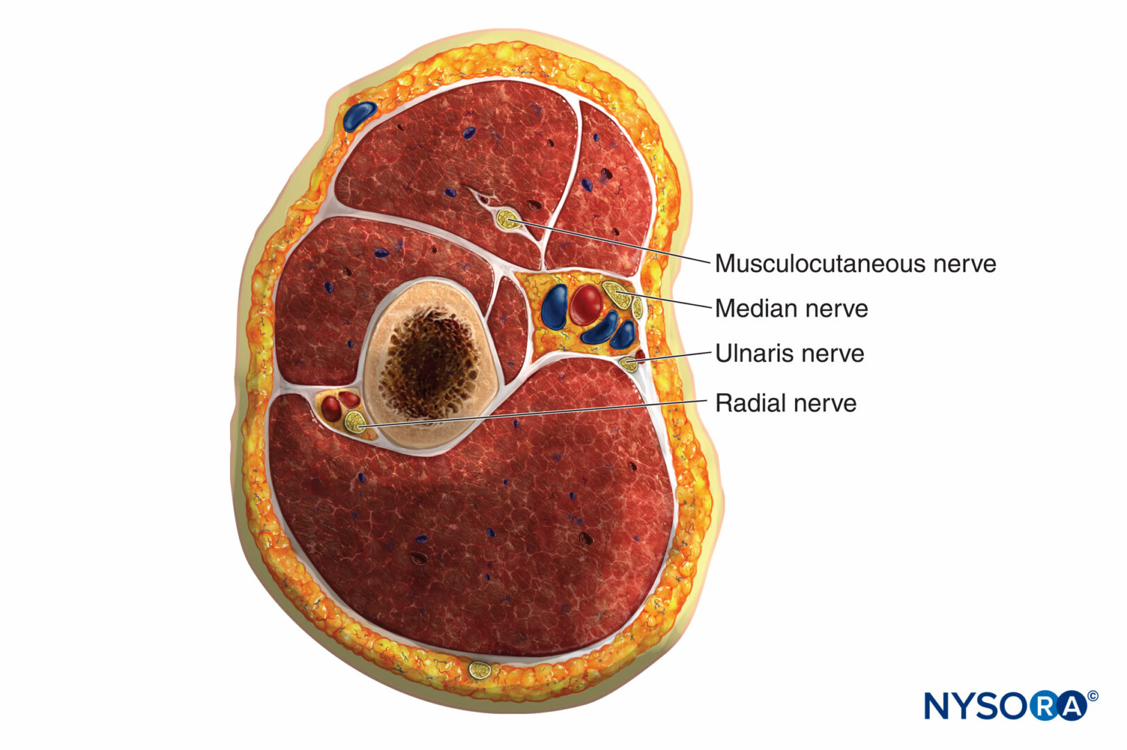 Sciatic Nerve Decompression: Background, Indications, Technical  Considerations