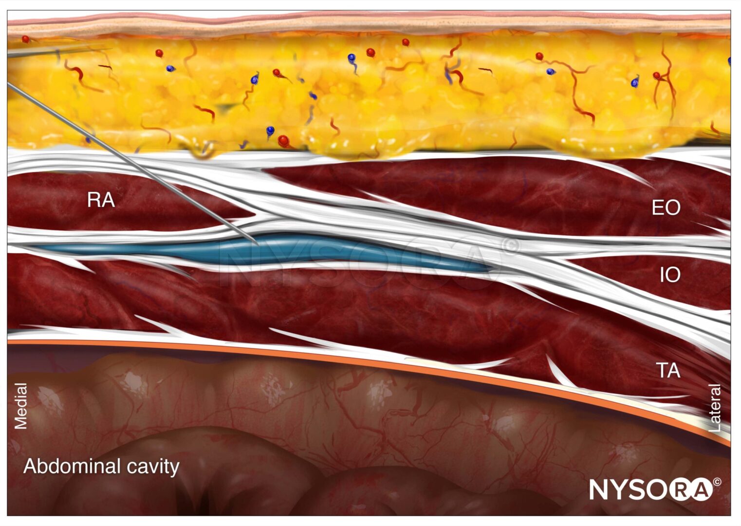 Farmacologia clinica degli anestetici locali - NYSORA