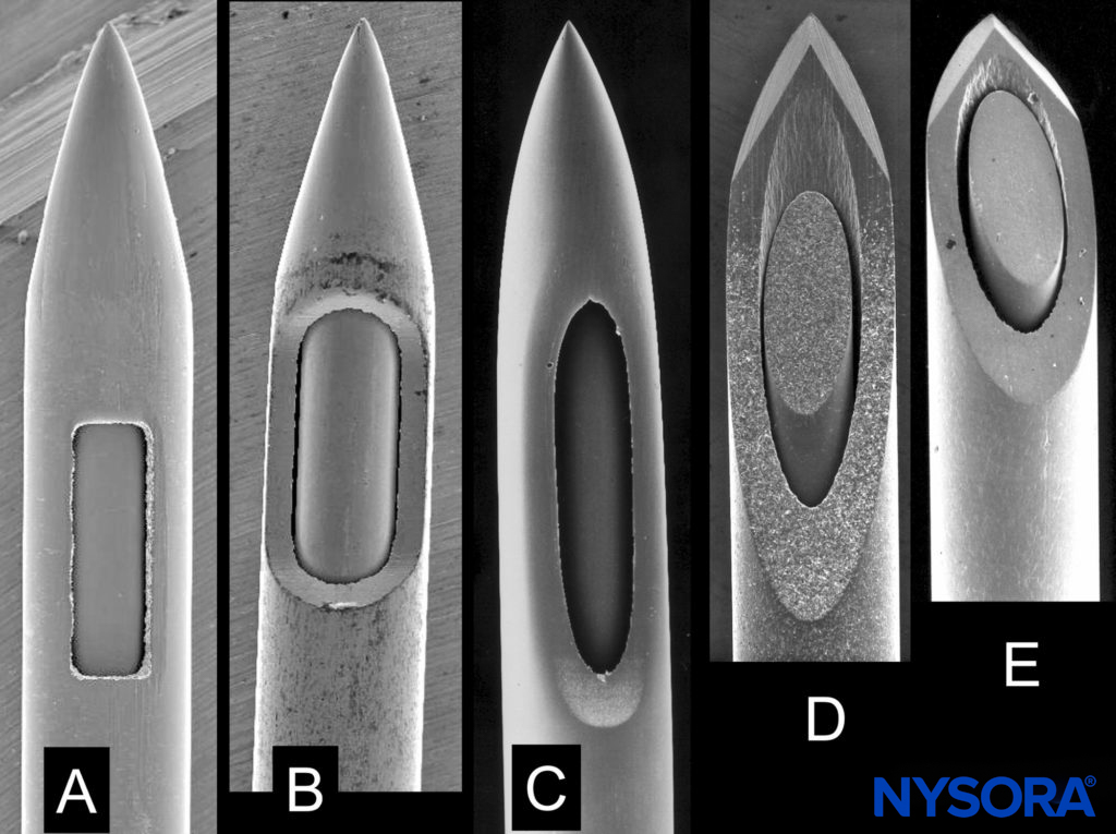 Spinal needles of different manufacturers with same external diameter. A: Whitacre type. B: Spinal type. C: Sprotte type. D, E: Quincke type. Scanning electron microscopy. Magnification ×40. (Reproduced with permission from Reina MA: Atlas of Functional Anatomy for Regional Anesthesia and Pain Medicine. Heidelberg: Springer; 2015.)