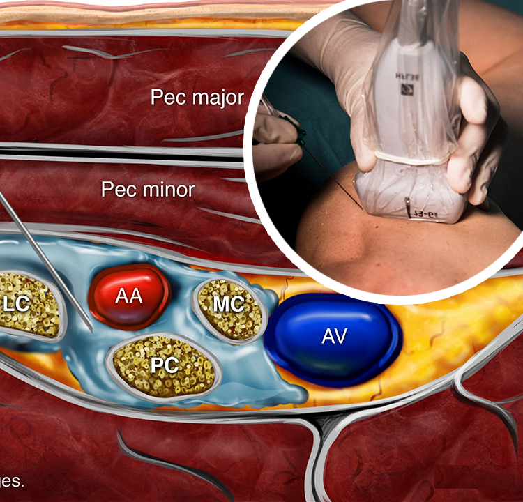 RAPTIR Block 5MS (2021) - Core Ultrasound