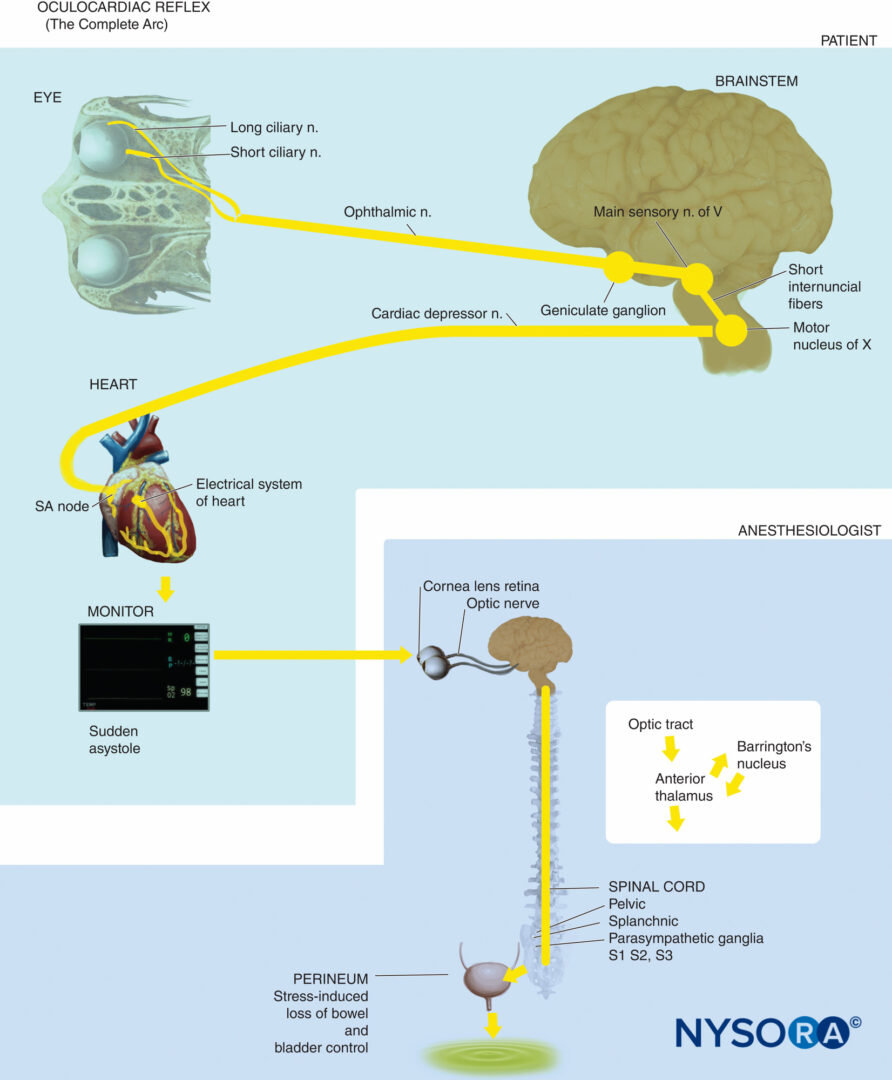 regionalanesthesiaoculocardiacreflexarc NYSORA NYSORA