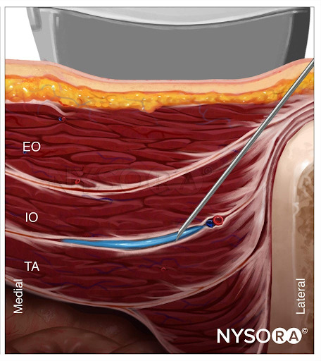 Farmacologia clinica degli anestetici locali - NYSORA