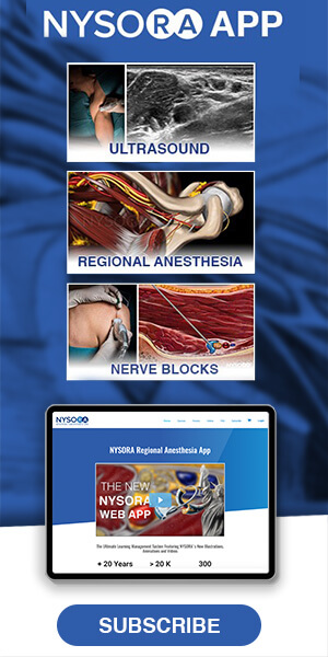 Postdural Puncture Headache Nysora
