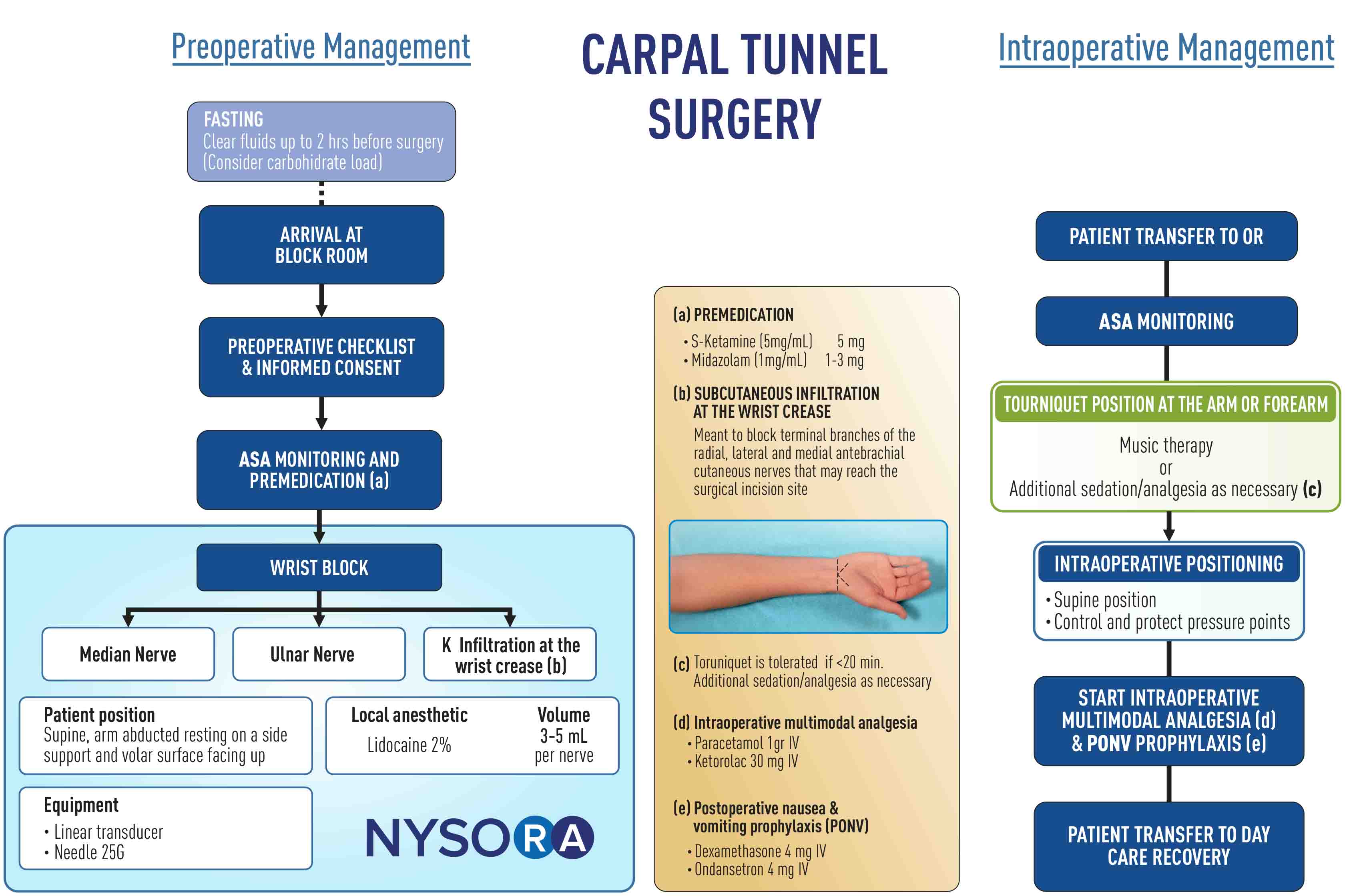 Estudio de caso: Liberación del túnel carpiano - NYSORA