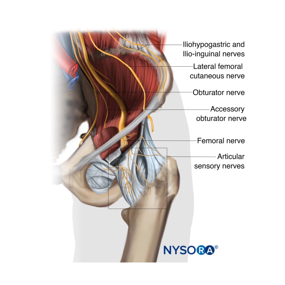 Femoral Nerve Block Nysora Femoral Nerve Block Nysora