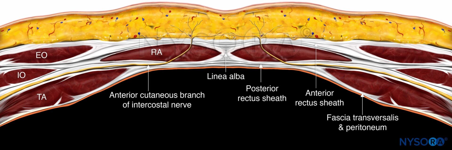 Anatomy Of Rectus Sheath