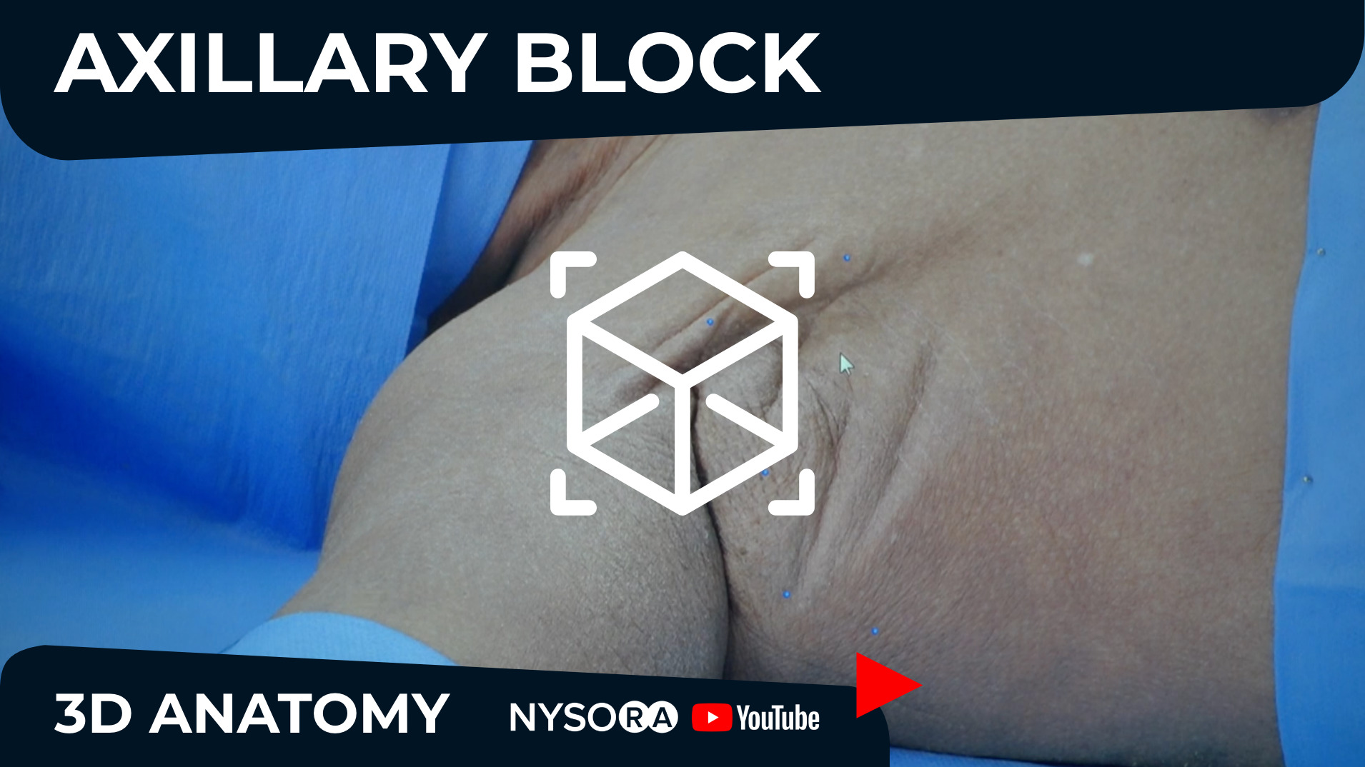 New video! Axillary Block Anatomy Explained - NYSORA’s 3D Anatomy videos
