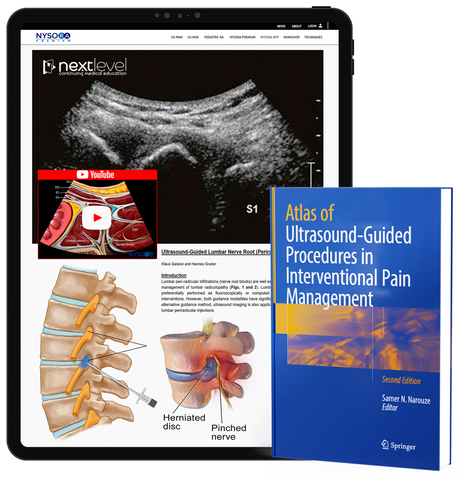 UltrasoundGuided Procedures in Interventional Pain Management NYSORA