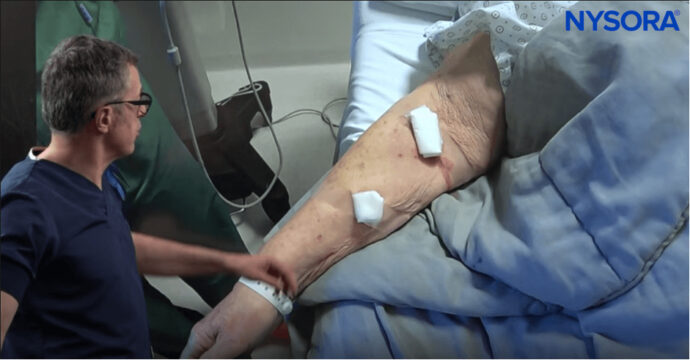 Best Technique for Difficult IV: Crash Course with Dr. Hadzic - NYSORA
