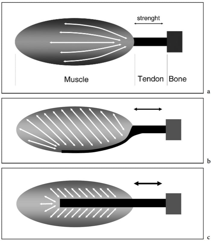 Muscles et Tendons - NYSORA