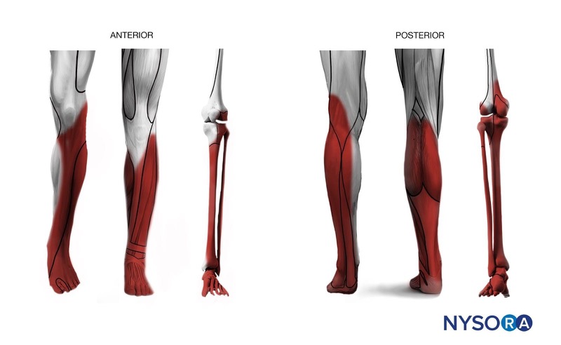 Lower Extremity Nerve Blocks Poster (in)