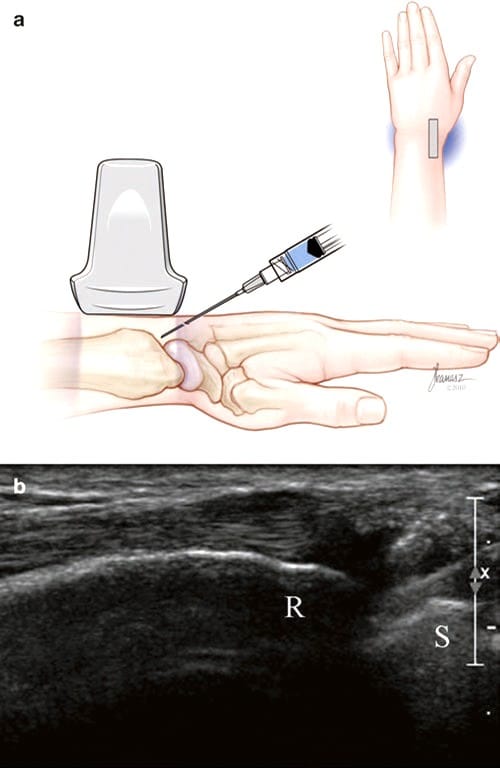 Mouvements des mains et des doigts : à gauche, supination et