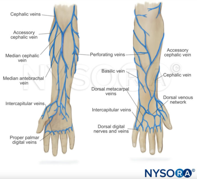 Difficult IV Access Cephalic Vein NYSORA
