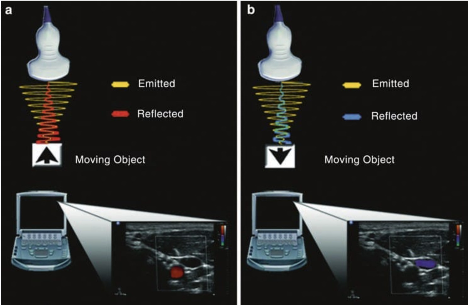Essential Knobology for Ultrasound-Guided Regional Anesthesia and Interventional Pain Management