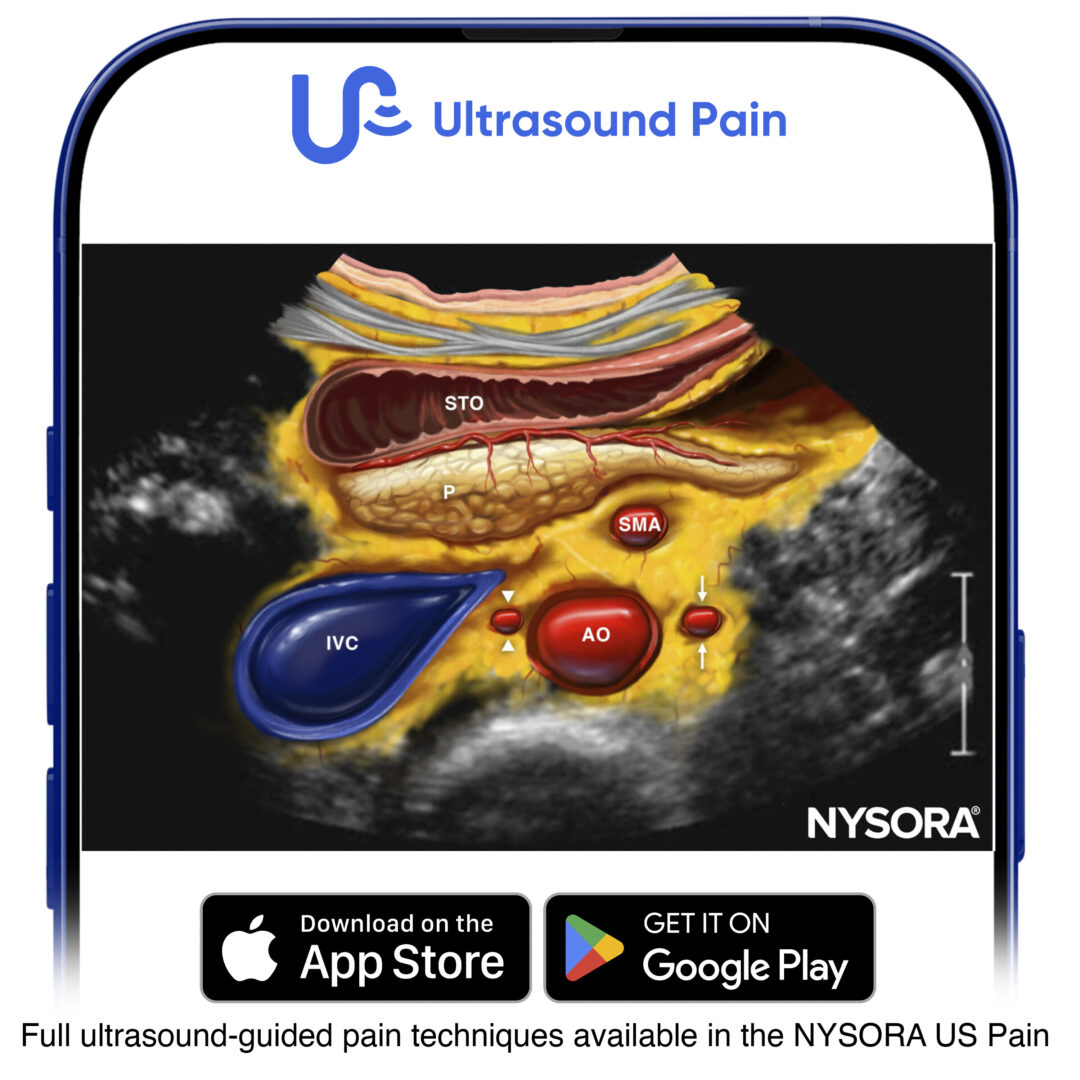 Ultrasound-Guided Celiac Plexus Block and Neurolysis