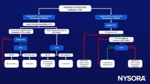 Pulmonary embolism, PE, D-dimer test, CTPA, RV dysfunction