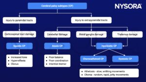 cerebral palsy, subtypes, pyramidal tract, extrapyramidal tract, spastic, ataxic, dyskinetic, choreoathetoid, dystonic, corticospinal tract damage, cerebellar damage, basal ganglia damage, thalamus damage, athetosis, chorea, tremor, coordination, balance, hyperreflexia, hypertonia, clonus, injury