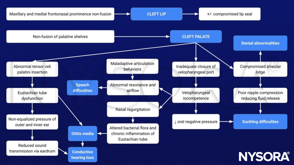 cleft lip, cleft palate, pathophysiology, dental abnormalities, suckling difficulties, speech difficulties, otitis media, conductive hearing loss, vesopharyngeal incompetence, Eustachian tube
