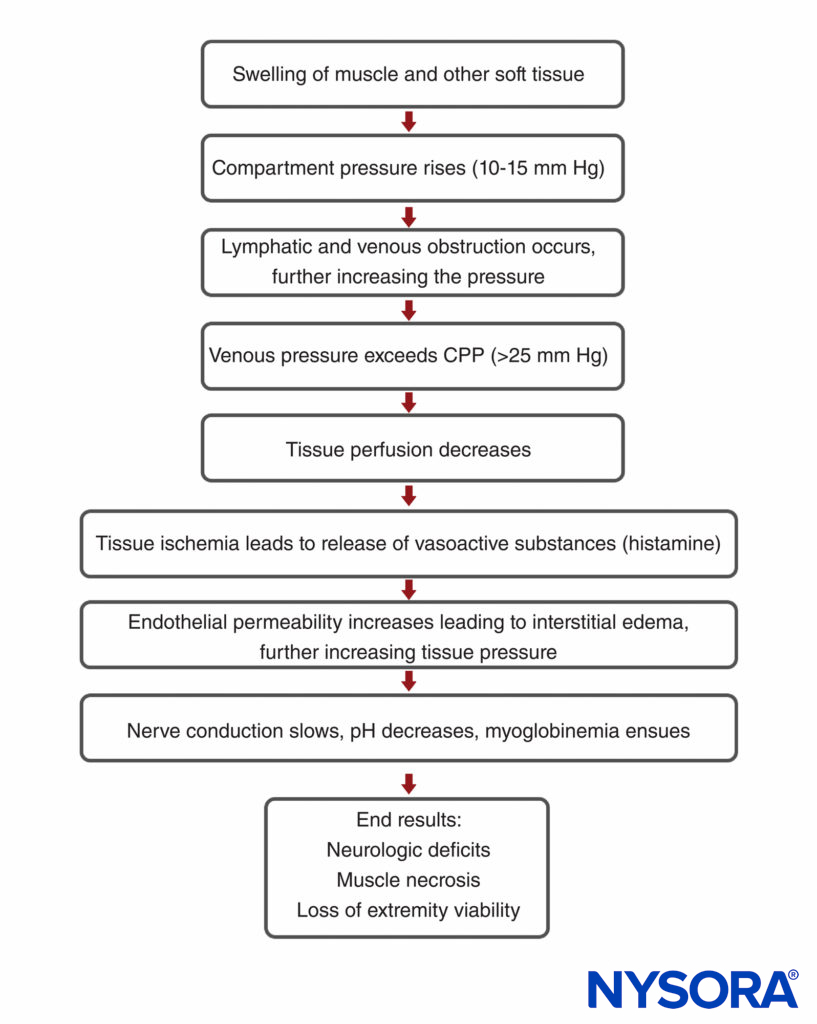 Compartment syndrome NYSORA
