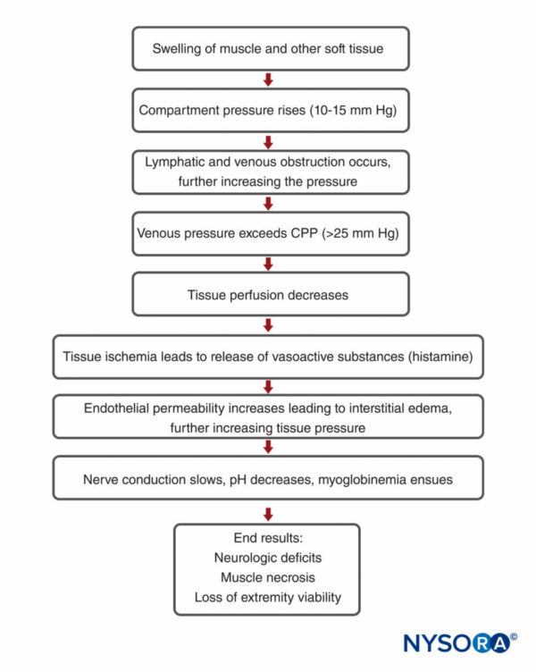 Compartment syndrome NYSORA NYSORA