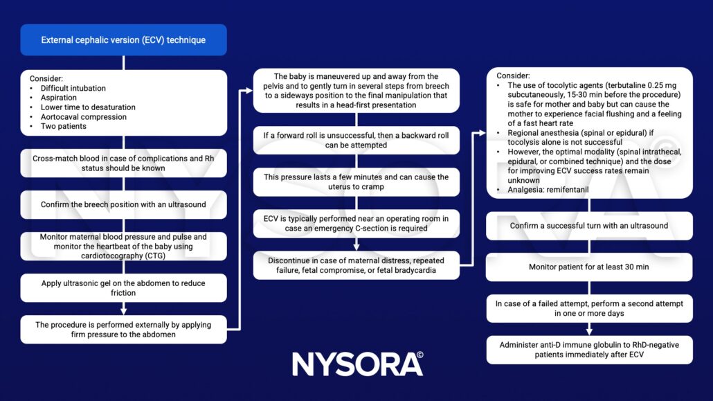 External cephalic version - NYSORA