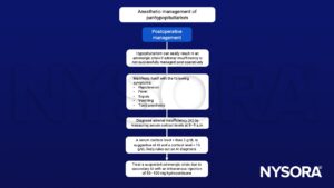 Panhypopituitarism, adrenergic crisis, adrenal insufficiency, cortisol, hydrocortisone