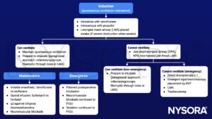 Pierre-Robin sequence, PRS, anesthesia, management, induction, sevoflurane, propofol, laryngeal mask airway, ventilation, intubation, oropharyngeal airway, NPA, isoflurane, opioid, sufentanil, fentanyl, dexmedetomidine, neuromuscular blockade, sedation, maintenance, emergence, laryngoscopy, bronchoscopy, tracheostomy