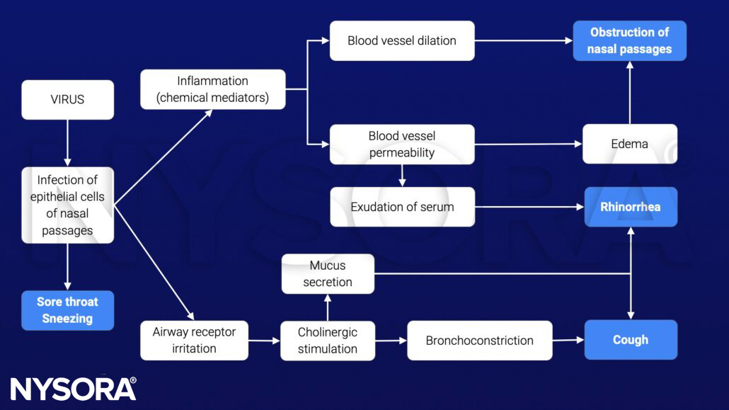 upper respiratory tract infection, URTI, pathophysiology, virus, infection, sore throat, sneezing, cough, rhinorrhea, obstruction nasal passages, edema, mucus, inflammation