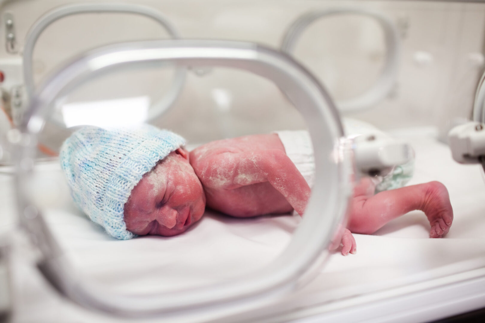 Premature Infant NYSORA