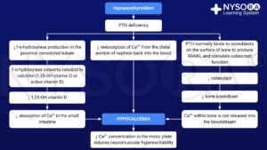 Patho des Hypoparathyreoidismus NYSORA