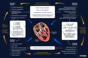 Right Heart Failure, congestion, preload, afterload, inotropy