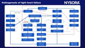 RV, tricuspid insufficiency, CVP, congestion, increased renal vein pressure, leftward septal shift, LVEDP, natriuretic peptides, blood pressure, glomerular pressure, vasodilation, stroke volume, cardiac output, RAAS, vasopressin, SNS, vasoconstriction, sodium and water restriction, renal perfusion, ischemia