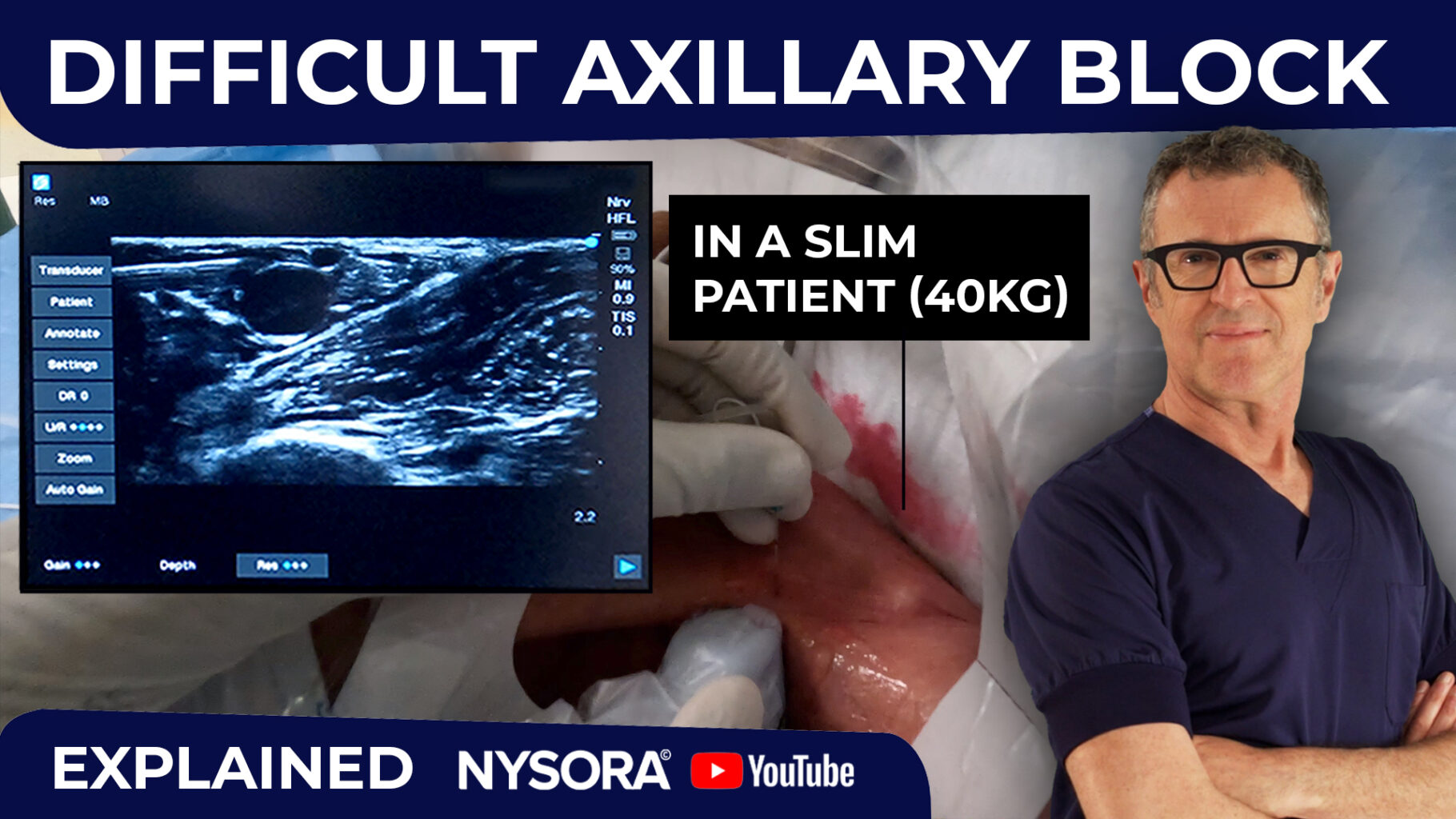 Difficult Axillary Block v3 NYSORA NYSORA