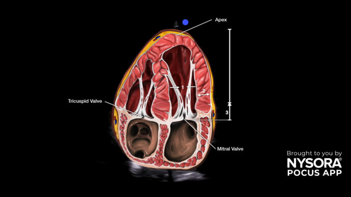 Caso clínico: Función ventricular izquierda