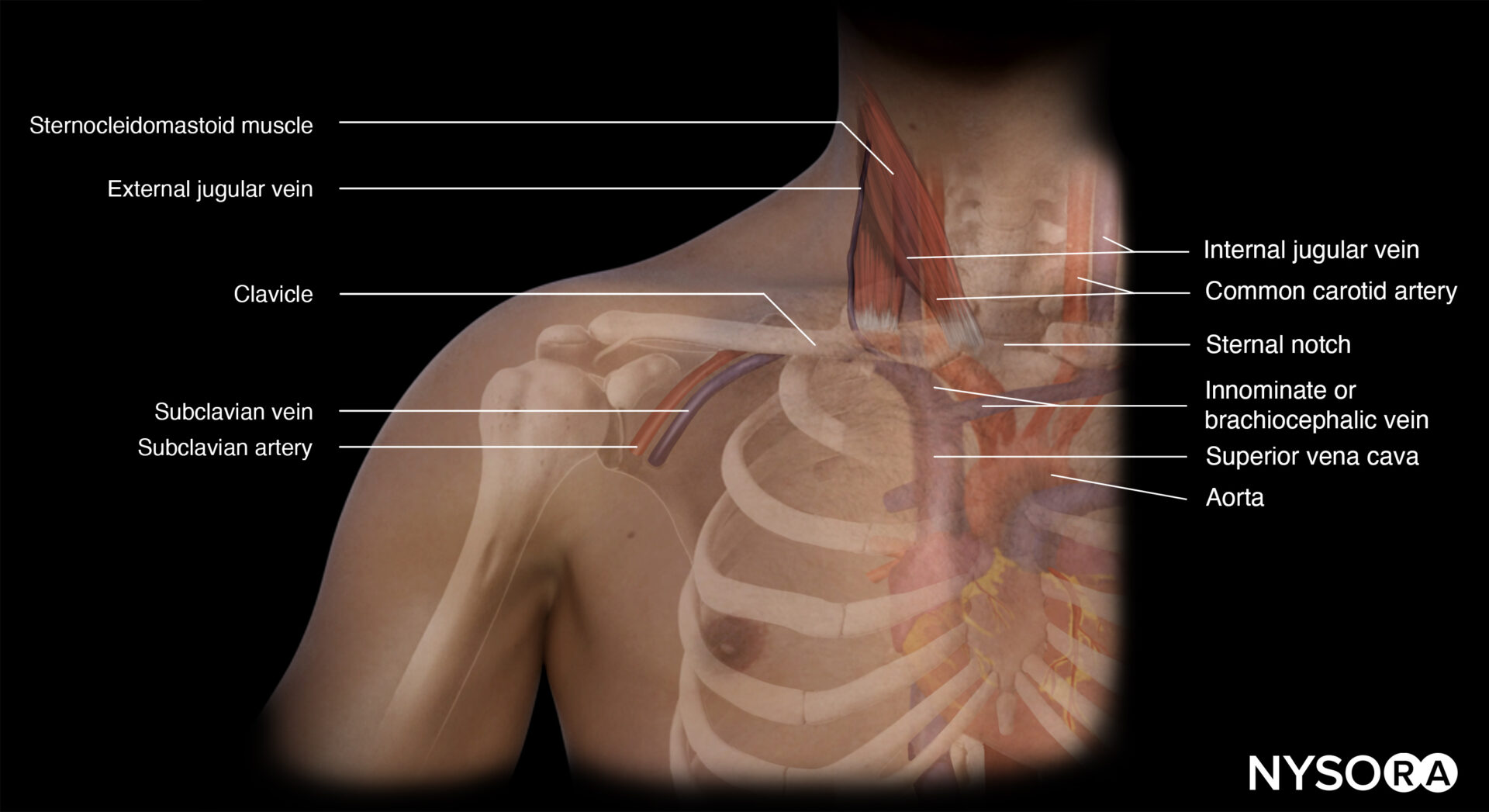Veia Jugular Externa Esquerda Veia Jugular Externa Esquerda