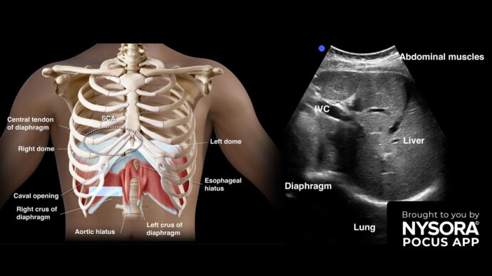 New POCUS course: Diaphragm ultrasound