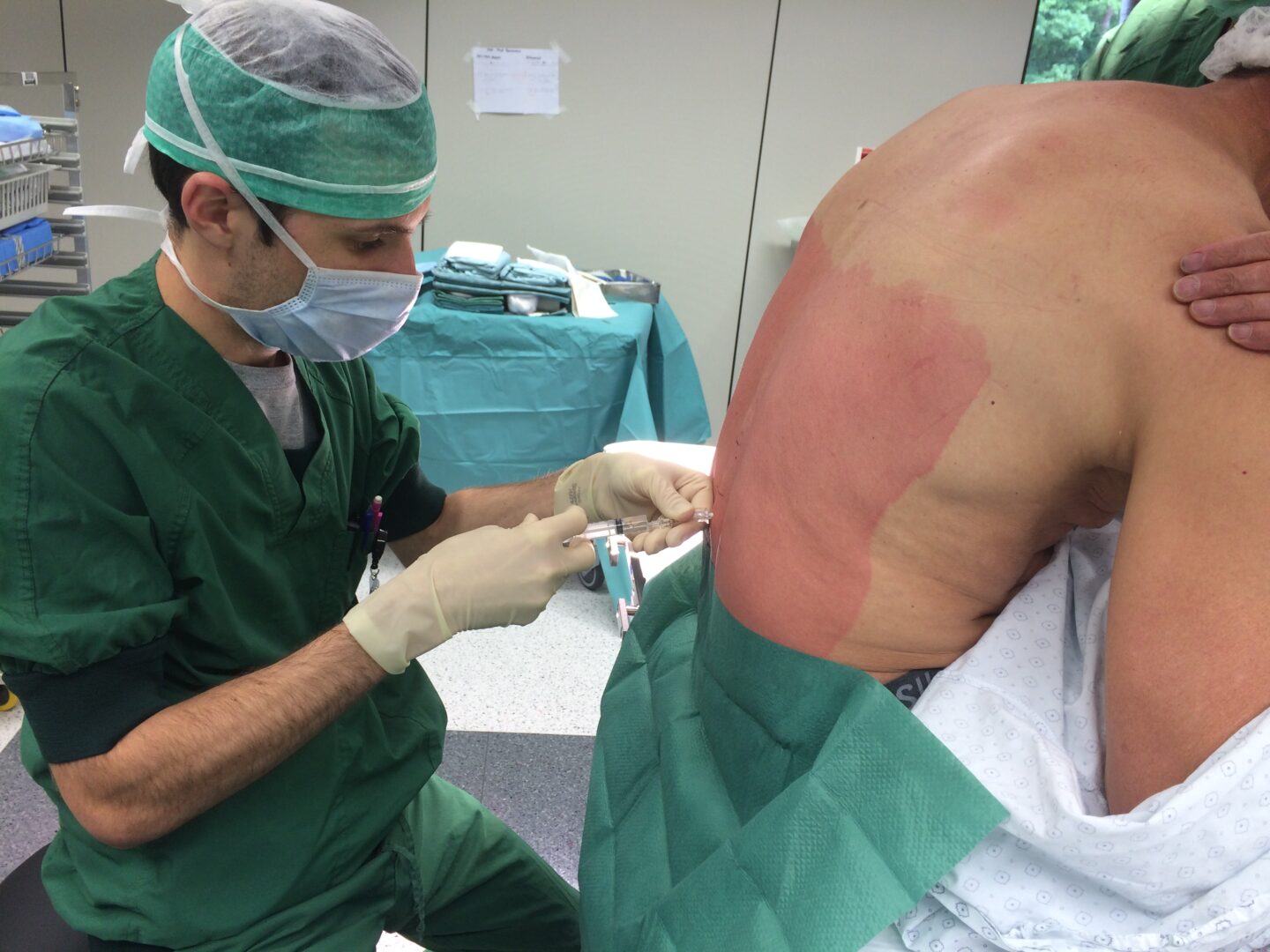 Epidural anesthesia