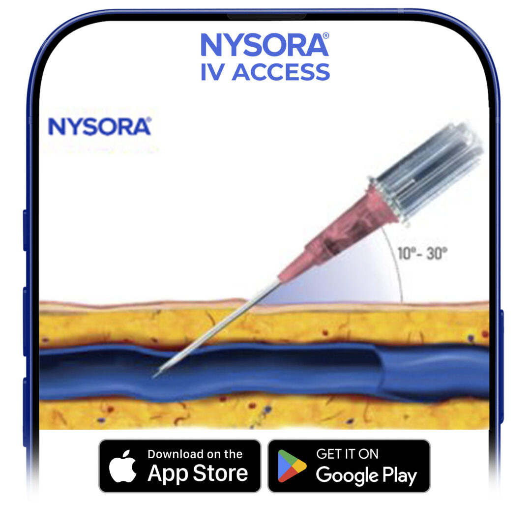 Angle of needle insertion for superficial veins.