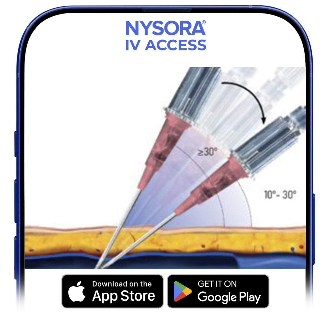 Decrease the angle. A too-steep angle will lead to puncturing the vein’s back wall.