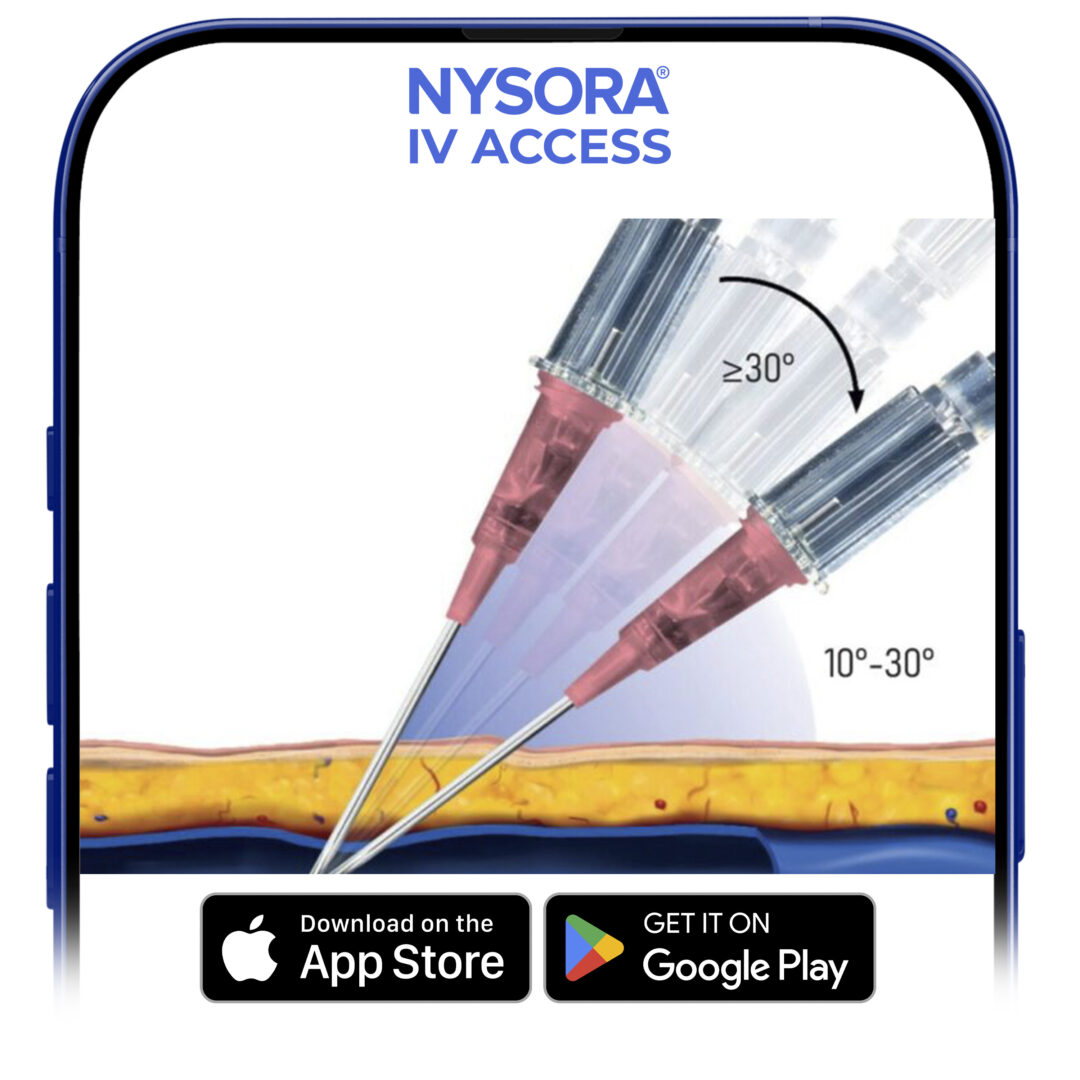 Lower the angle of the needle-catheter 