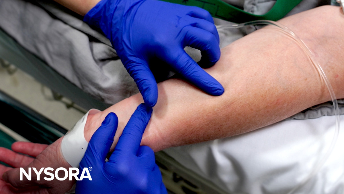 Large vein cannulation