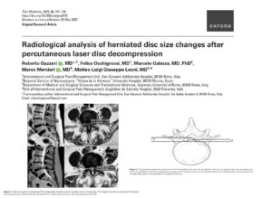 Percutaneous laser disc decompression offers significant relief for lumbar disc herniation