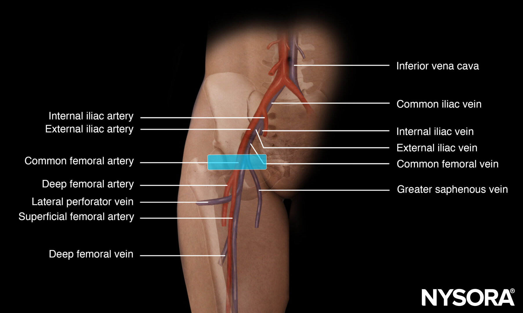Femoral vein cannulation