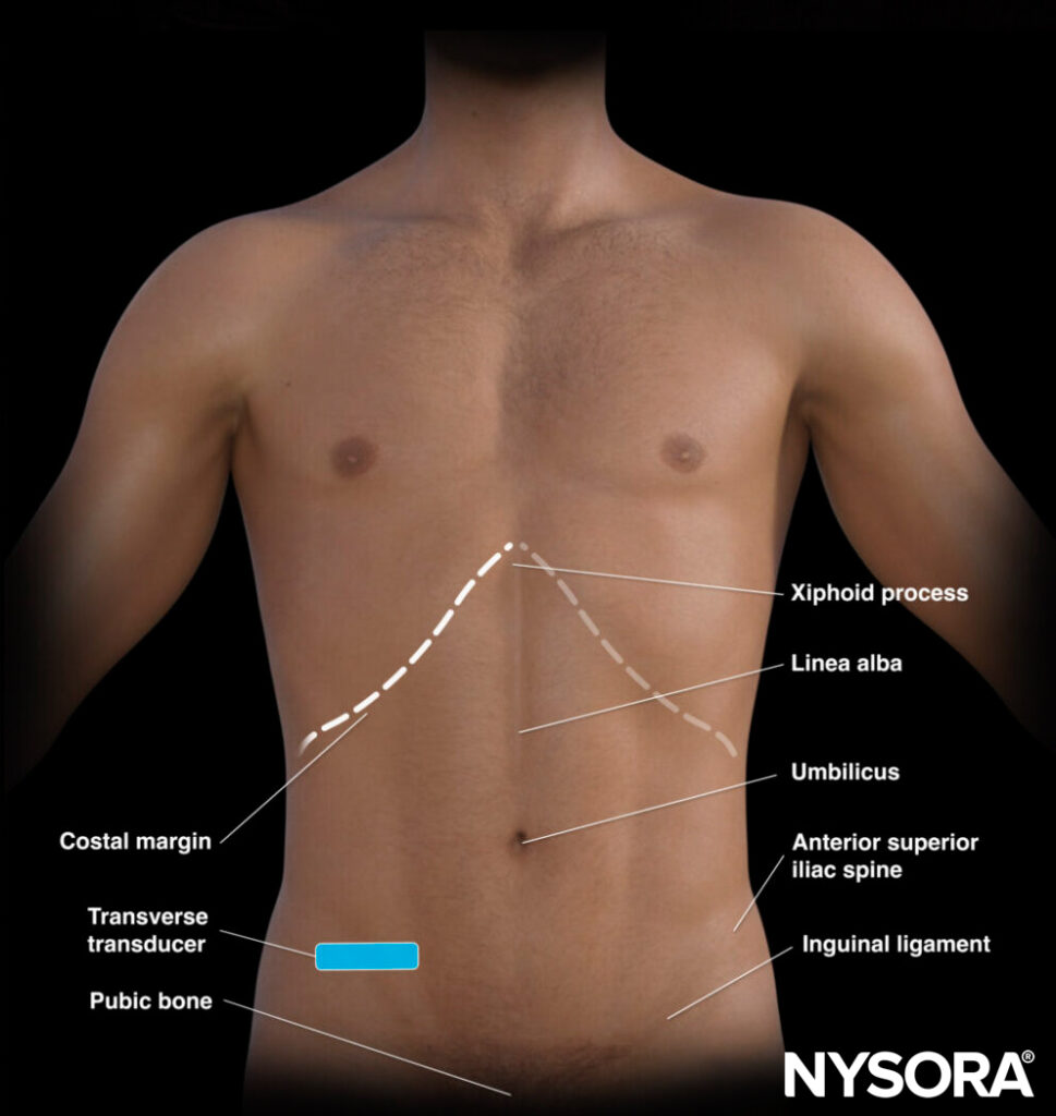 Bowel assessment - NYSORA