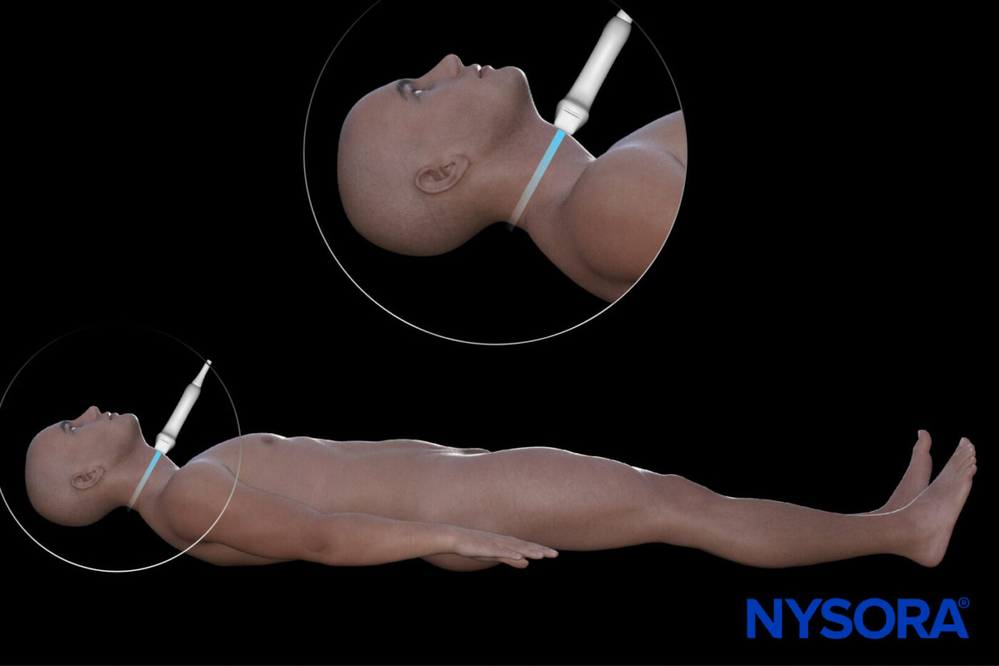 Inlet Scan Position Airway assessment - NYSORA