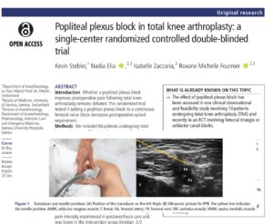 Popliteal plexus block in TKA: A small gain or a meaningful step forward?